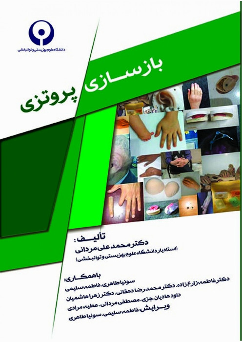 بازسازی پروتزی